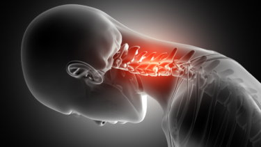 前方頚椎症候群の原因・症状・治療法