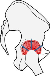 股関節屈曲位における関節包靭帯の状態