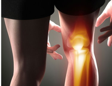 膝蓋骨（膝蓋大腿関節）の関節運動学